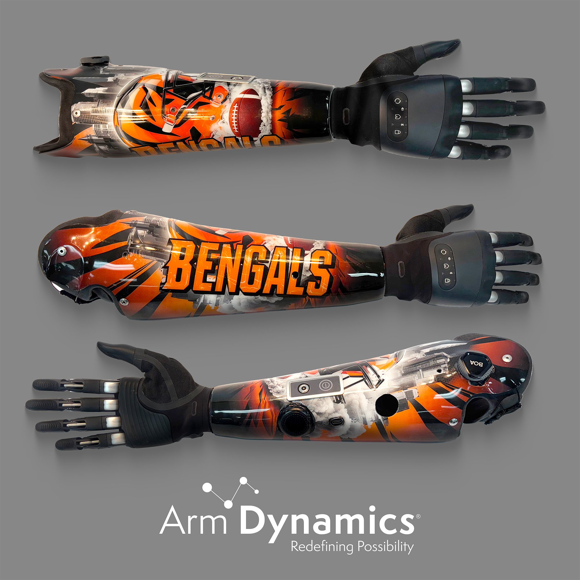 Cincinnati Bengals Transradial