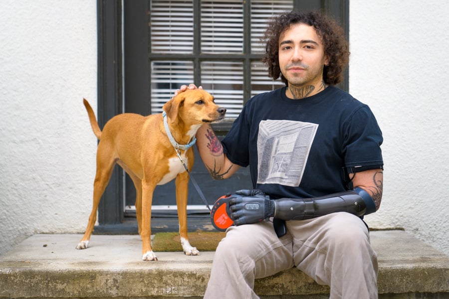 Wrist Level Amputee sits on porch and loves on his dog